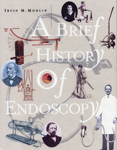 history of endoscopy